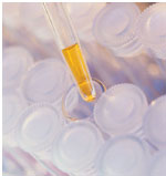 Genetic Factors