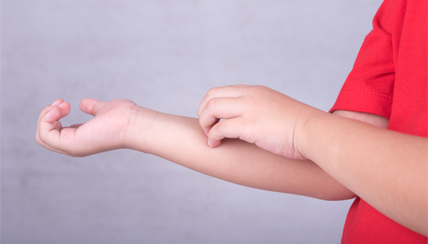 young child scratching eczema on arm