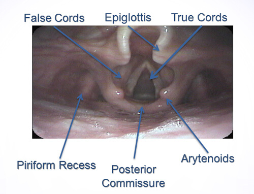 SILP Normal Upper Airway