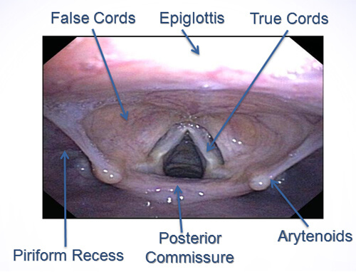 SILP Normal Upper Airway