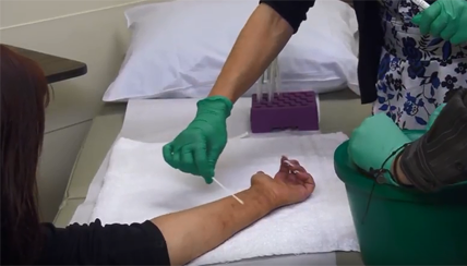 Clinical Trial Offers Natural Eczema Treatment, Using Good Bacteria to Fight the Bad