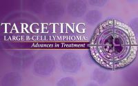 Targeting Large B-Cell Lymphoma