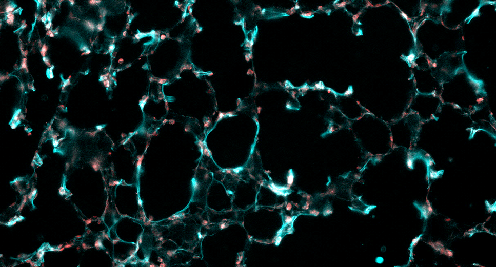 Redente Research Laboratory 