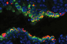 Stijn De Langhe, PhD, has discovered key cells and molecular signals that allow the lung to repair itself.