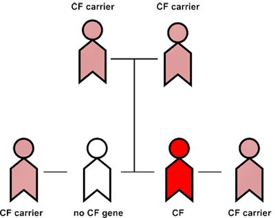 Diagram of how cystic fibrosis is inherited