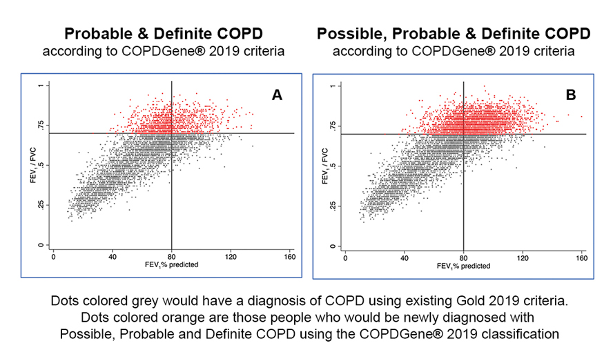 New Diagnostic Criteria Proposed  For Chronic Obstructive Pulmonary Disease (COPD)