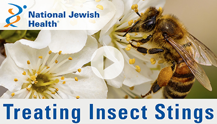 treating insect stings video