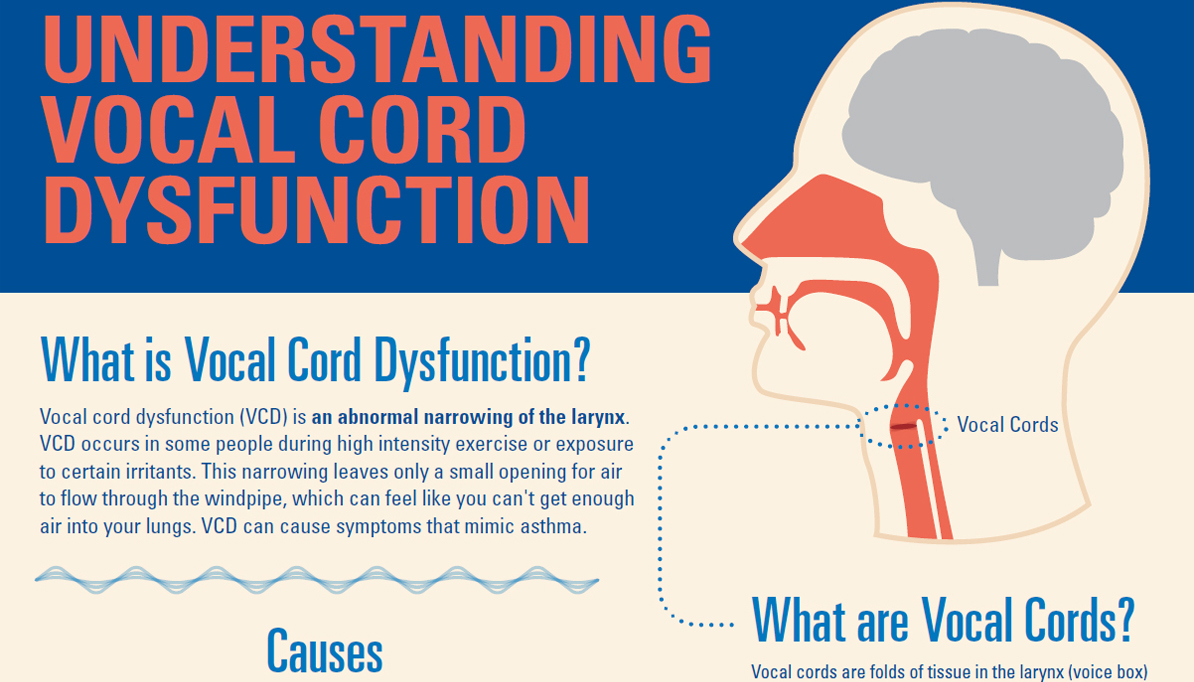 understanding vocal cord dysfunction