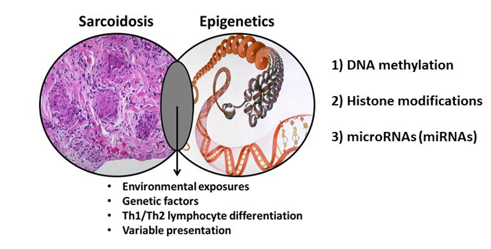 sarcoidosis epigenetics links