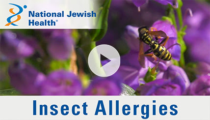 insect allergies video