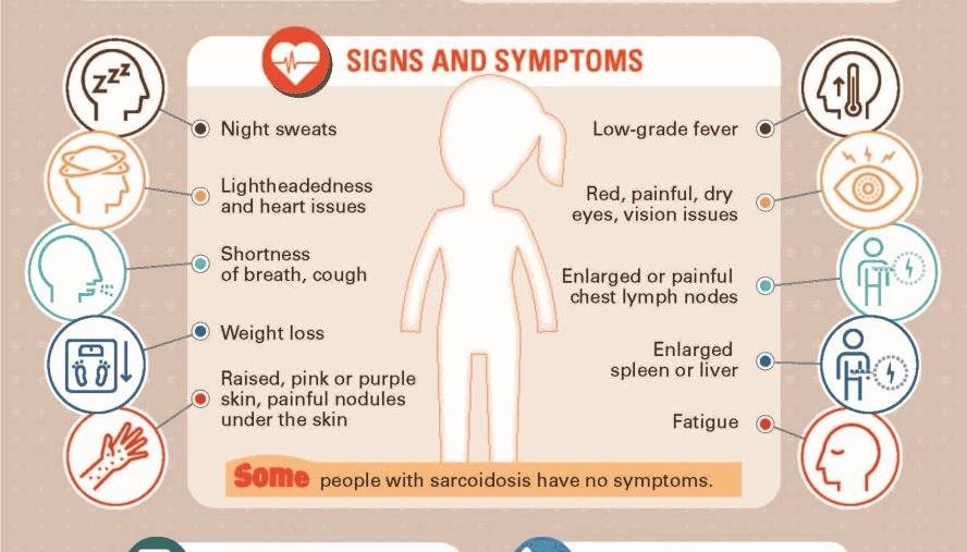 understanding sarcoidosis