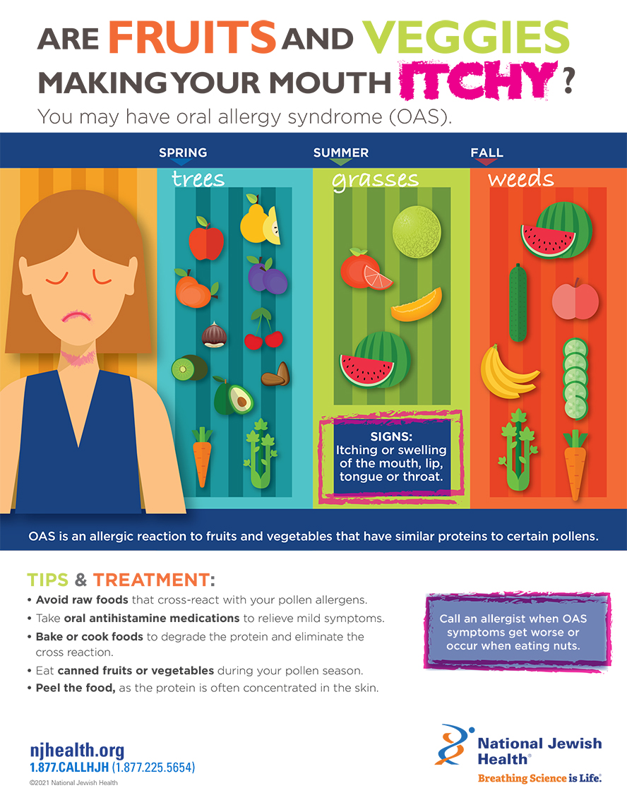 Oral allergy syndrome infographic