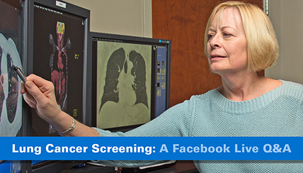 Lung cancer screening video banner