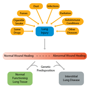 Diagram of normal lung vs ILD