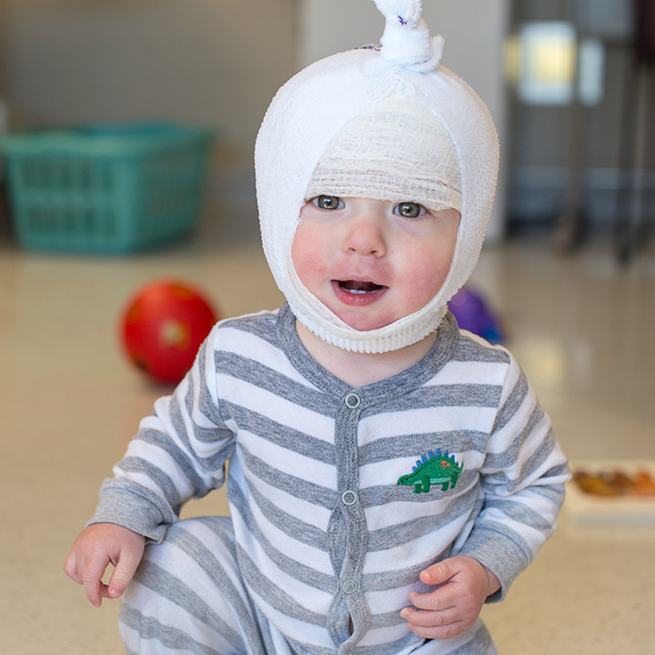 pediatric eczema care
