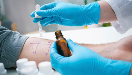 Allergy Test being performed on an arm