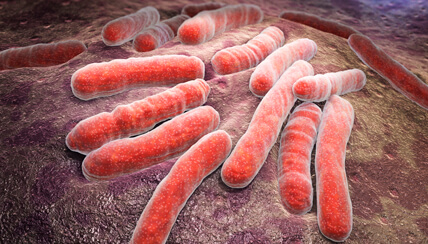 tuberculosis medical illustration tuberculosis medical illustration